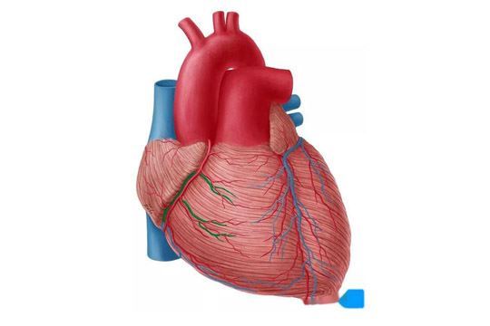 心血管夹层：一种严重的心血管疾病相关图片